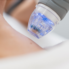 Microneedling with PRP/PRF 8 pack