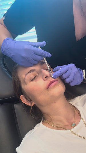 The Bombshell Package: Mini Lip Filler + Free Glo2 Oxygen Facial